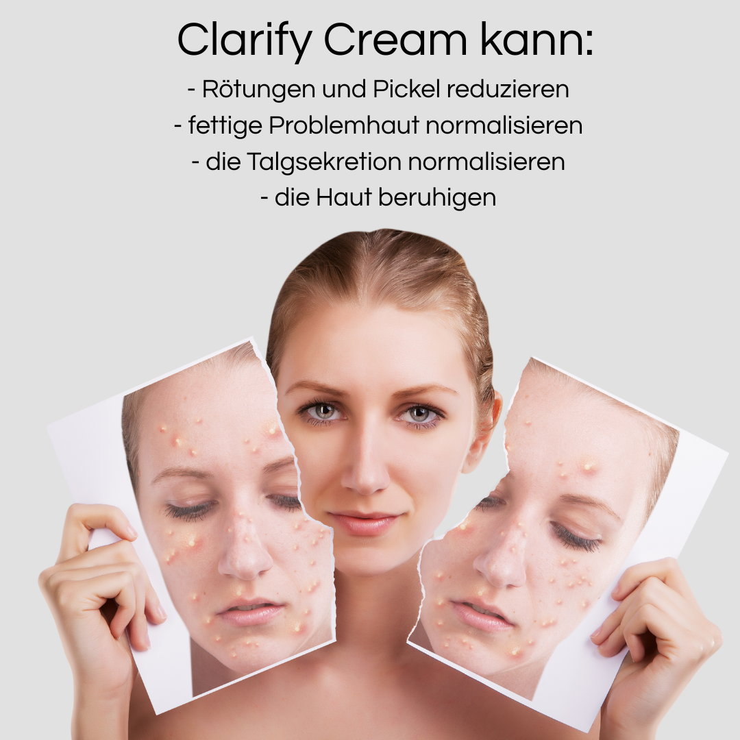 Clarify Cream 30ml