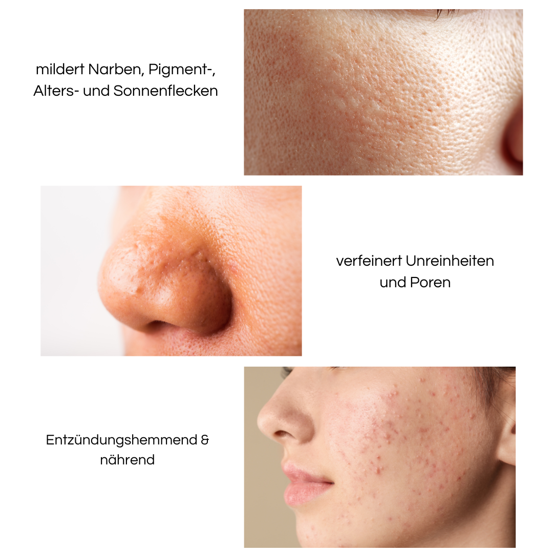 Triple Acid Serum 30ml